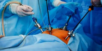 Cirurgia Vídeo-Laparoscópia