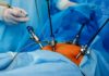 Cirurgia Vídeo-Laparoscópia